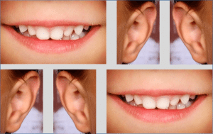 Collage van monden en oren van kinderen.